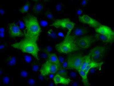 Immunocytochemistry/ Immunofluorescence: IFIT3 Antibody (OTI1G1) [NBP2-02148]