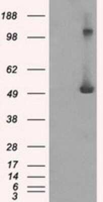 Western Blot: IFIT3 Antibody (OTI1G1) [NBP2-02148]