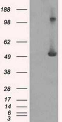 Western Blot: IFIT3 Antibody (OTI1G1)Azide and BSA Free [NBP2-71006]