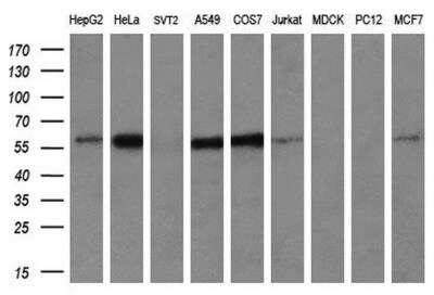 Western Blot: IFIT3 Antibody (OTI1G1) [NBP2-02148]