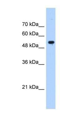 Western Blot: IFIT3 Antibody [NBP1-56632]