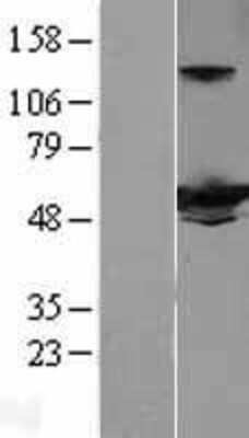 Western Blot: IFIT3 Overexpression Lysate [NBL1-11836]