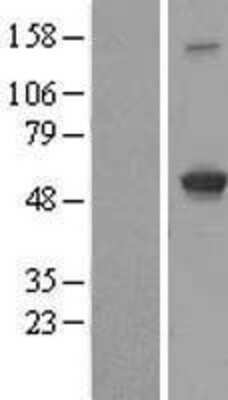 Western Blot: IFIT3 Overexpression Lysate [NBL1-11837]