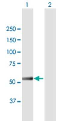 Western Blot: IFIT5 Antibody [H00024138-B01P]