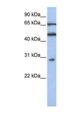 Western Blot: IFIT5 Antibody [NBP1-58886]