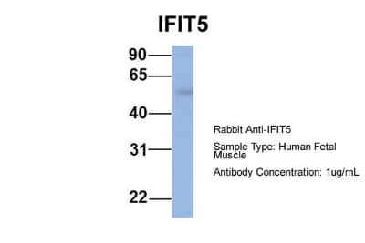 Western Blot: IFIT5 Antibody [NBP1-58887]