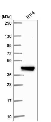 Western Blot: IFIT5 Antibody [NBP2-56869]