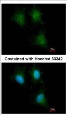 Immunocytochemistry/ Immunofluorescence: IFITM1 Antibody [NBP2-16922]