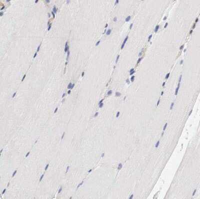 Immunohistochemistry-Paraffin: IFITM1 Antibody [NBP1-89345]