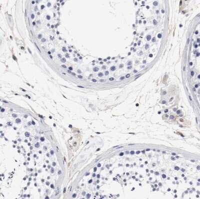 Immunohistochemistry-Paraffin: IFITM1 Antibody [NBP1-89345]
