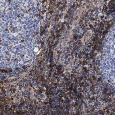 Immunohistochemistry-Paraffin: IFITM1 Antibody [NBP1-89345]