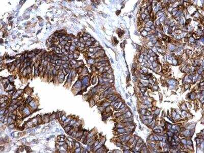 Immunohistochemistry-Paraffin: IFITM1 Antibody [NBP2-16922]