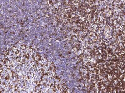 Immunohistochemistry-Paraffin: IFITM1 Antibody [NBP2-98695]