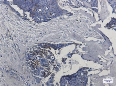 Immunohistochemistry-Paraffin: IFITM1 Antibody (S07-7F8) [NBP3-19659]