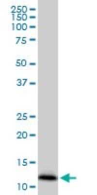 Western Blot: IFITM2 Antibody (1F2) [H00010581-M14]