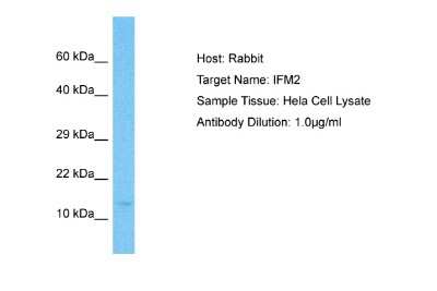 Western Blot: IFITM2 Antibody [NBP2-82252]