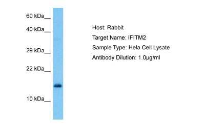 Western Blot: IFITM2 Antibody [NBP2-82255]