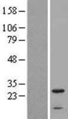 Western Blot: IFITM2 Overexpression Lysate [NBL1-11840]