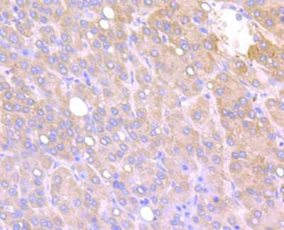 Immunohistochemistry-Paraffin: IFITM3/Fragilis Antibody (JU73-02) [NBP2-75533]