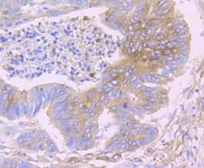 Immunohistochemistry-Paraffin: IFITM3/Fragilis Antibody (JU73-02) [NBP2-75533]