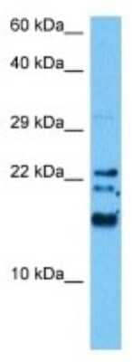 Western Blot: IFITM3/Fragilis Antibody [NBP3-10067]