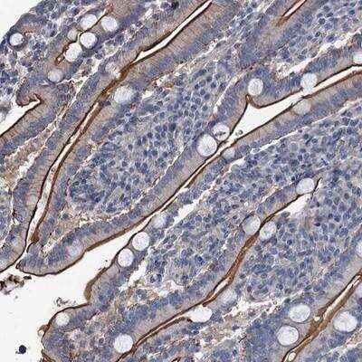 Immunohistochemistry: IFITM5 Antibody [NBP1-90752]