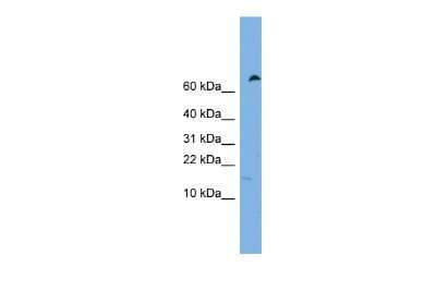 Western Blot: IFITM5 Antibody [NBP2-83072]