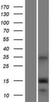 Western Blot: IFITM5 Overexpression Lysate [NBP2-08631]