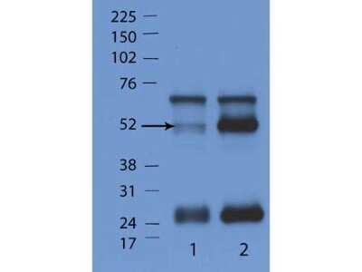 Western Blot: IFN Induced GTPase-like Protein Antibody [NBP2-44169]