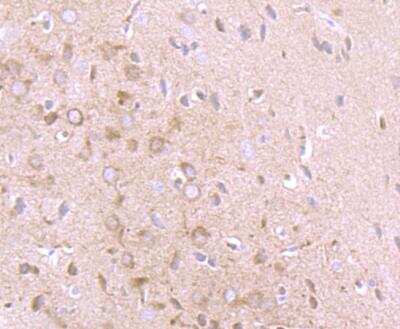 Immunohistochemistry-Paraffin: IFN-alpha 1 Antibody [NBP2-75930]