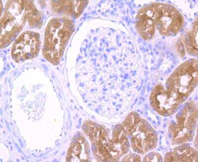 Immunohistochemistry-Paraffin: IFN-alpha 1 Antibody [NBP2-75930]