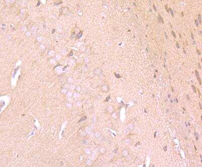 Immunohistochemistry-Paraffin: IFN-alpha 1 Antibody [NBP2-75930]