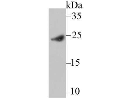 Western Blot: IFN-alpha 1 Antibody [NBP2-75930]