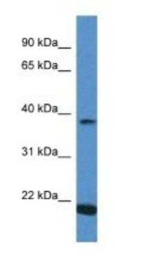 Western Blot: IFN-alpha 13 Antibody [NBP1-74124]