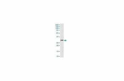 Western Blot: IFN-alpha 2 Antibody (N27) [NBP3-18803]