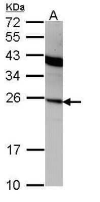 Western Blot: IFN-alpha 2 Antibody [NBP2-42866]