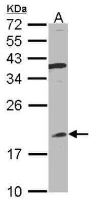 Western Blot: IFN-alpha B2/IFN-alpha 8 Antibody [NBP1-31603]