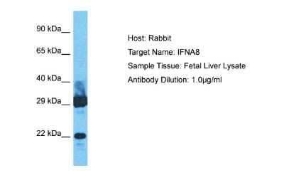 Western Blot: IFN-alpha B2/IFN-alpha 8 Antibody [NBP2-82256]