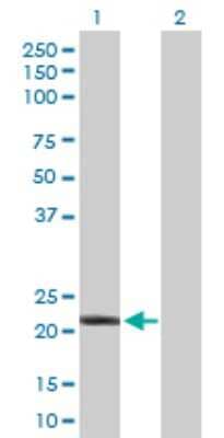 Western Blot: IFN-alpha C/IFN-alpha 10 Antibody [H00003446-D01P]