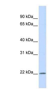 Western Blot: IFN-alpha G/IFNA5 Antibody [NBP1-57915]