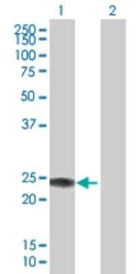 Western Blot: IFN-alpha H2/IFNA14 Antibody [H00003448-B01P]