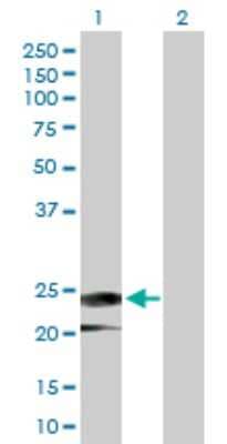 Western Blot: IFN-alpha H2/IFNA14 Antibody [H00003448-D01P]