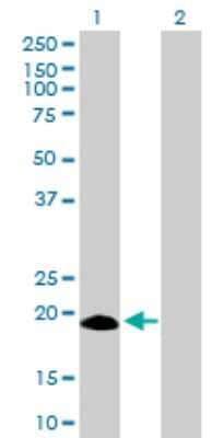 Western Blot: IFN-alpha I/IFNA17 Antibody [H00003451-B01P]