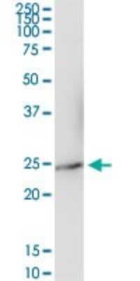 Western Blot: IFN-alpha I/IFNA17 Antibody [H00003451-D01P]