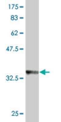 Western Blot: IFN-kappa Antibody (1B7) [H00056832-M01]