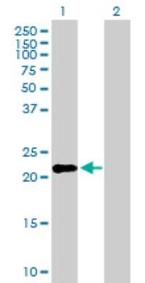 Western Blot: IFN-kappa Antibody [H00056832-B01P]