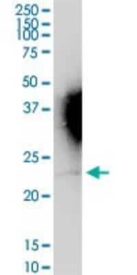 Western Blot: IFN-alpha WA/IFNA16 Antibody [H00003449-D01P]