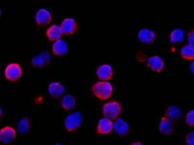 Immunocytochemistry/ Immunofluorescence: IFN-alpha/beta R1 Antibody (110) [NBP2-90600]