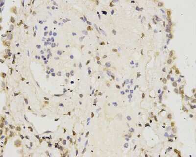 Immunohistochemistry-Paraffin: IFN-alpha/beta R1 Antibody (A5-A3) [NBP2-75534]
