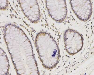 Immunohistochemistry-Paraffin: IFN-alpha/beta R1 Antibody (A5-A3) [NBP2-75534]